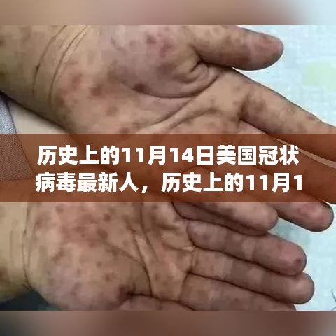 歷史上的11月14日，美國冠狀病毒最新進(jìn)展回顧與展望