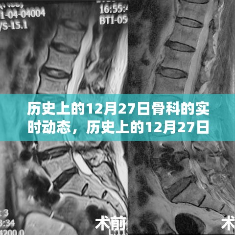 歷史上的骨科領(lǐng)域動態(tài)，聚焦十二月二十七日的實時進展概覽