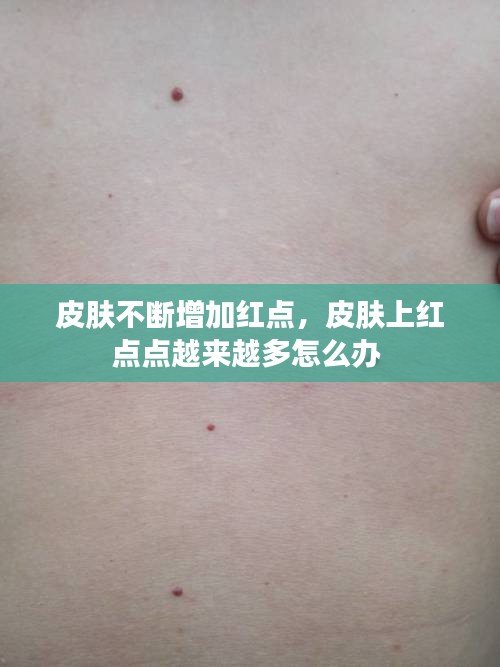 皮膚不斷增加紅點(diǎn)，皮膚上紅點(diǎn)點(diǎn)越來越多怎么辦 
