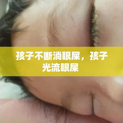 孩子不斷淌眼屎，孩子光流眼屎 