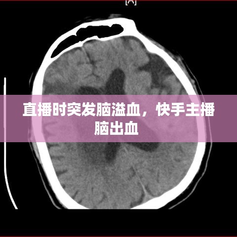 直播時突發(fā)腦溢血，快手主播腦出血 