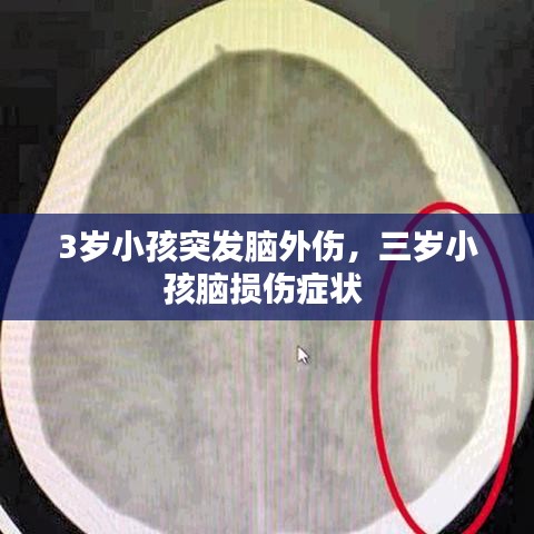3歲小孩突發(fā)腦外傷，三歲小孩腦損傷癥狀 