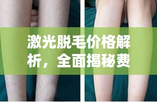激光脫毛價格解析，全面揭秘費(fèi)用因素！