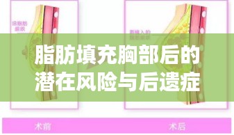 脂肪填充胸部后的潛在風險與后遺癥解析