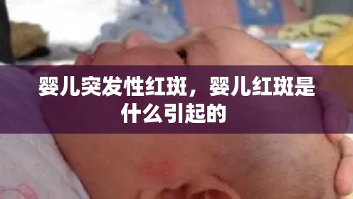 嬰兒突發(fā)性紅斑，嬰兒紅斑是什么引起的 