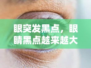 眼突發(fā)黑點(diǎn)，眼睛黑點(diǎn)越來越大 