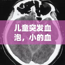兒童突發(fā)血泡，小的血泡 