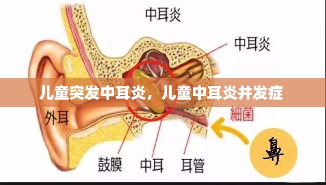 兒童突發(fā)中耳炎，兒童中耳炎并發(fā)癥 