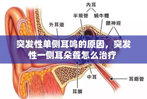 突發(fā)性單側(cè)耳鳴的原因，突發(fā)性一側(cè)耳朵聾怎么治療 